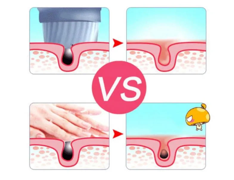 Rolli B Pore Sonic Cleanser